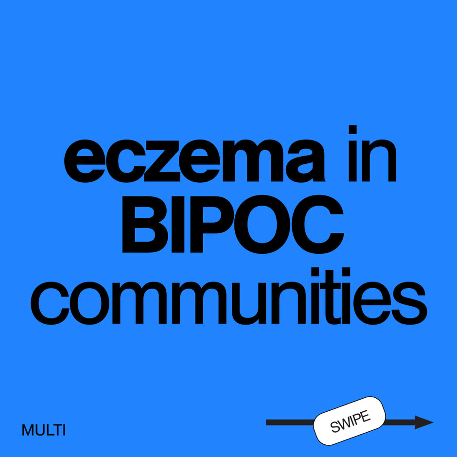 ECZEMA IN BIPOC COMMUNITIES
